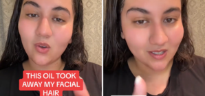 Woman Says Surprising Product Reduced Her Facial Hair—So We Asked an Expert