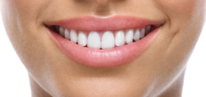 Dentist Reveals What She Does Instead of ‘Harmful’ Teeth-Whitening Trend