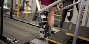 New prosthetics restore natural movement via nerve connection
