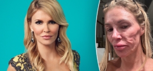 Brandi Glanville shares stripped down photo as she claims her ‘looks are ruined’ by mystery illness