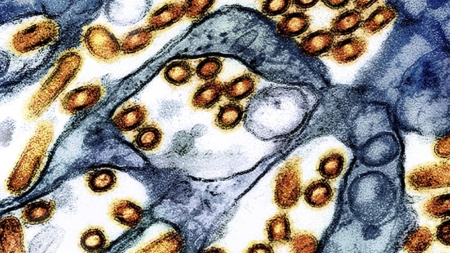 In the Central Valley lack of wastewater testing for bird flu a blind spot
