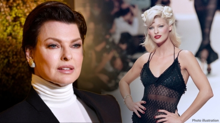 Damage from CoolSculpting procedure left model Linda Evangelista in therapy