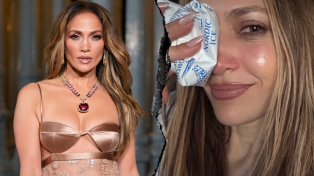 Jennifer Lopez reveals facial injury from American Music Awards rehearsal