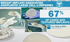 FDA proposes “black-box warning” for breast implants