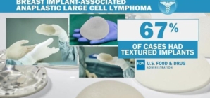 FDA proposes “black-box warning” for breast implants