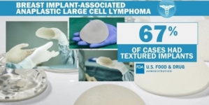 FDA proposes “black-box warning” for breast implants