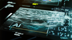 FDA approves first AI tool to predict breast cancer risk