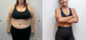 Woman Wants to Improve Mental Health Before 50th, Then She Dropped 100lbs
