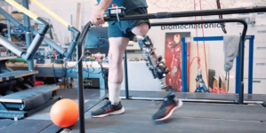 Bionic knee helps amputees walk naturally again