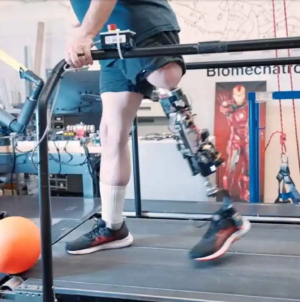 Bionic knee helps amputees walk naturally again