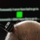 Paralyzed man speaks and sings with AI brain-computer interface
