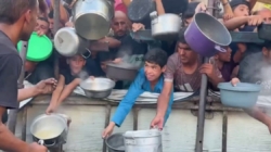 9% of Gaza’s children have severe malnutrition