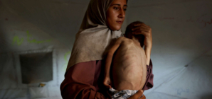 How a Viral Image Is Fueling the Fight over Reports of Starvation in Gaza
