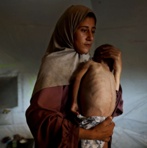 How a Viral Image Is Fueling the Fight over Reports of Starvation in Gaza