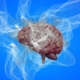Researchers Advance in Finding Cure for Alzheimer’s