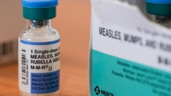 Traveler with measles landed at LAX, stayed at nearby Hilton