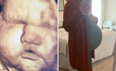 3D Scan Predicted Big Baby—Then She Arrived: ‘Thank Goodness for Epidurals’