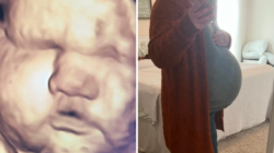 3D Scan Predicted Big Baby—Then She Arrived: ‘Thank Goodness for Epidurals’