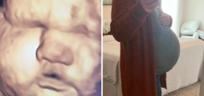 3D Scan Predicted Big Baby—Then She Arrived: ‘Thank Goodness for Epidurals’