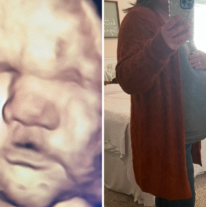 3D Scan Predicted Big Baby—Then She Arrived: ‘Thank Goodness for Epidurals’