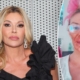 Brandi Glanville burns face with Nair to treat facial parasite condition