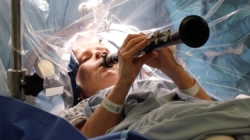 Music meets medicine as Parkinson’s patient plays clarinet during brain surgery