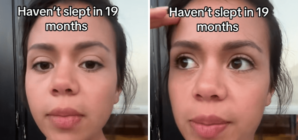 Millennial Woman Hasn’t Slept the Night in 19 Months—Viewers Shocked Why