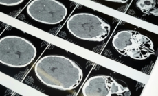 China develops ultrasound brain-computer interface without surgery