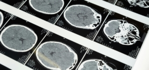 China develops ultrasound brain-computer interface without surgery