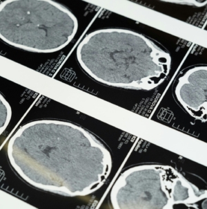 China develops ultrasound brain-computer interface without surgery