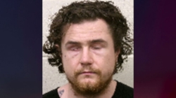 Murder suspect who gouged out his own eyes, bit off part of tongue deemed competent to stand trial