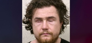 Murder suspect who gouged out his own eyes, bit off part of tongue deemed competent to stand trial