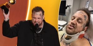 Jelly Roll attended 2026 Grammy Awards with ‘secret’ broken collarbone